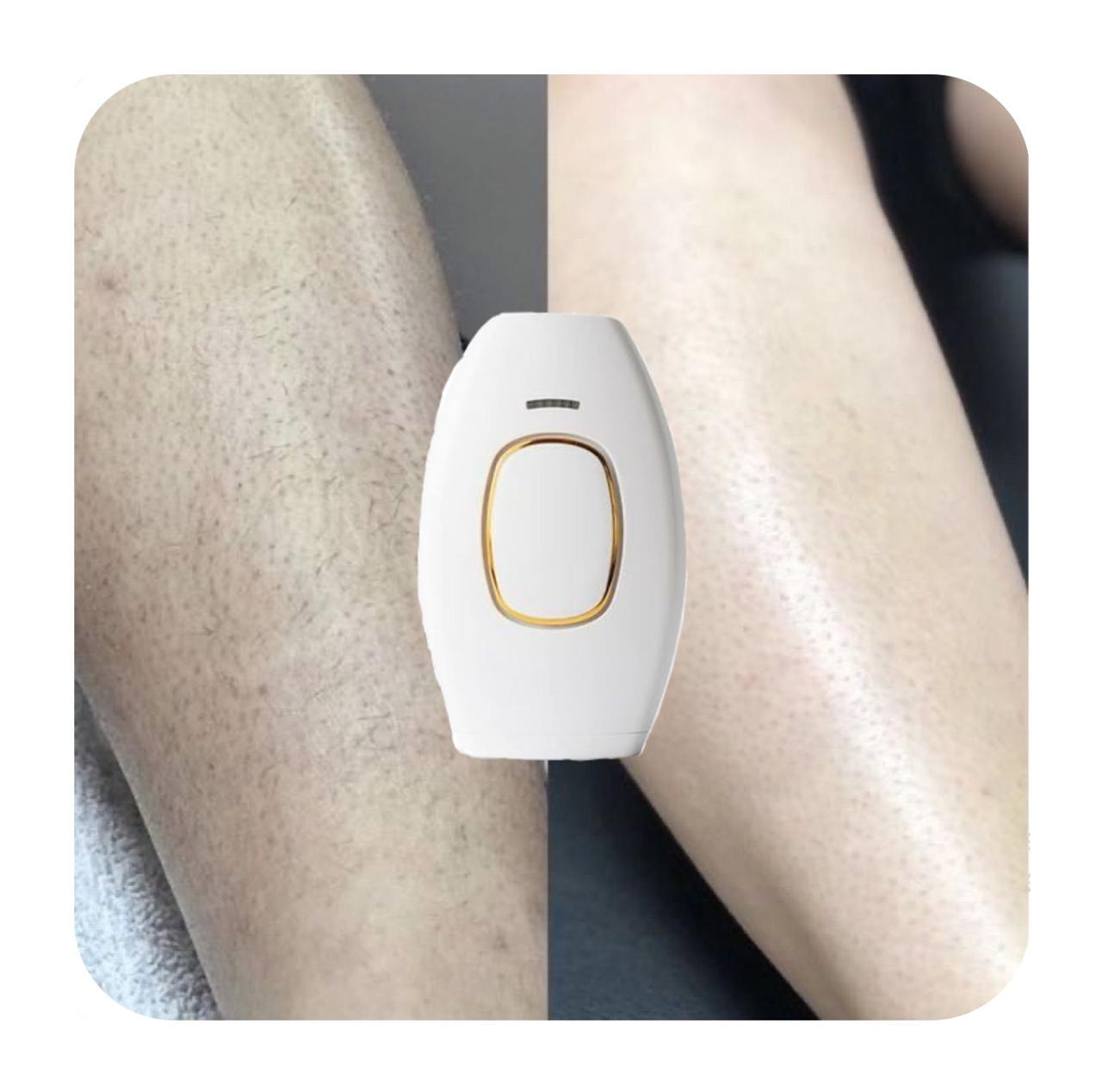 Depiladora Láser - IPL 2 _ FRETE GRÁTIS _ 🇨🇴